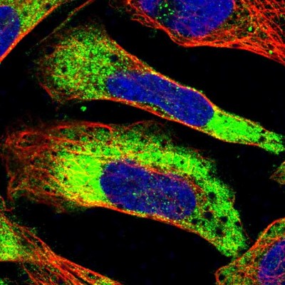 Immunocytochemistry/Immunofluorescence: G3BP2 Antibody [NBP1-82976] - Immunofluorescent staining of human cell line U-2 OS shows localization to cytosol.