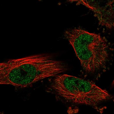 Immunocytochemistry/Immunofluorescence: NKX6.1 Antibody [NBP1-82553] - Immunofluorescent staining of human cell line U-251 MG shows localization to nucleoplasm.
