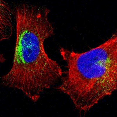 Immunocytochemistry/Immunofluorescence: Syntaxin 7 Antibody [NBP1-87497] - Staining of human cell line U-251 MG shows localization to lysosomes.