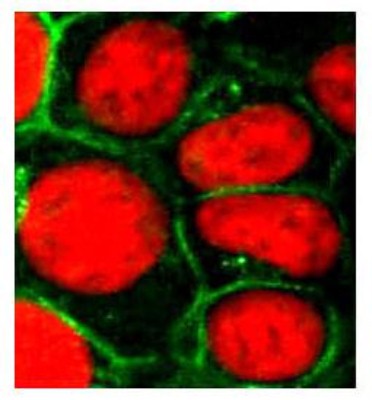 Immunocytochemistry/Immunofluorescence: MRP1 Antibody (IU5C1) [NB110-57131] - Immunofluorescent staining of MRP1 using NB110-57131 in HEK293 cells with MRP1 expression.