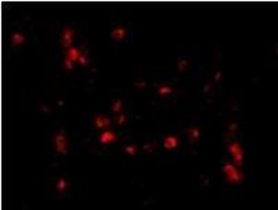 Immunocytochemistry/Immunofluorescence: CAMP/LL37/FALL39/Cathelicidin Antibody [NBP1-76864] - in Human Spleen cells.