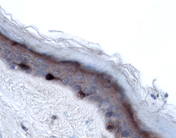 Langerin/CD207 was detected in immersion fixed paraffin-embedded sections of human skin using 15 µg/mL Goat Anti-Human Langerin/CD207 Antigen Affinity-purified Polyclonal Antibody (Catalog # AF2088) overnight at 4 °C. Tissue was stained with the Anti-Goat HRP-DAB Cell & Tissue Staining Kit  (brown; Catalog # CTS008) and counterstained with hematoxylin (blue). Specific labeling was localized to the cytoplasm of Langerhans cells in the skin epidermis. View our protocol for Chromogenic IHC Staining of Paraffin-embedded Tissue Sections.