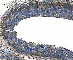 ROBO1 was detected in immersion fixed frozen sections of rat embryo (neural tube) using 5 µg/mL Goat Anti-Rat ROBO1 Antigen Affinity-purified Polyclonal Antibody (Catalog # AF1749) overnight at 4 °C. Tissue was stained with the Anti-Goat HRP-DAB Cell & Tissue Staining Kit (brown; Catalog # CTS008) and counterstained with hematoxylin (blue). View our protocol for Chromogenic IHC Staining of Frozen Tissue Sections.