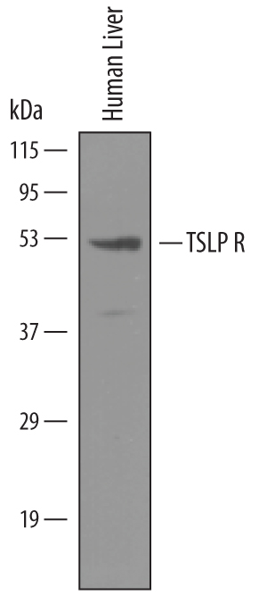Western blot shows lysates of human liver tissue. PVDF membrane was probed with 1 µg/mL of Goat Anti-Human TSLP R Antigen Affinity-purified Polyclonal Antibody (Catalog # AF981) followed by HRP-conjugated Anti-Goat IgG Secondary Antibody (Catalog # HAF019). A specific band was detected for TSLP R at approximately 50 kDa (as indicated). This experiment was conducted under reducing conditions and using Immunoblot Buffer Group 8.