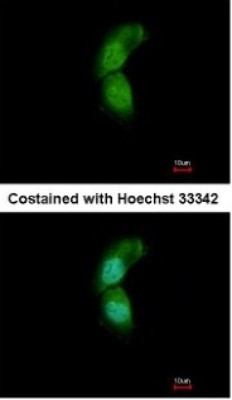Immunocytochemistry/Immunofluorescence: TRIM32 Antibody [NBP1-33737] - Paraformaldehyde-fixed A431, using antibody at 1:500 dilution.