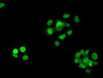 Immunocytochemistry/Immunofluorescence: RPA2 Antibody (9A1) [NBP2-02182] - Staining of COS7 cells transiently transfected by pCMV6-ENTRY RPA2.