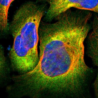 Immunocytochemistry/Immunofluorescence: FLNC Antibody [NBP1-89300] - Immunofluorescent staining of human cell line U-2 OS shows localization to plasma membrane & cytosol.