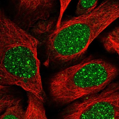 Immunocytochemistry/Immunofluorescence: RAP80 Antibody [NBP1-87156] - Staining of human cell line U-2 OS shows localization to nucleus & nuclear bodies.