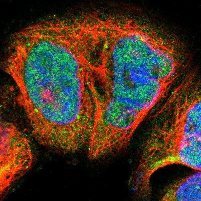 Immunocytochemistry/Immunofluorescence: Blooms Syndrome Protein Blm Antibody [NBP1-89929] - Staining of human cell line A-431 shows positivity in nucleus and cytoplasm.