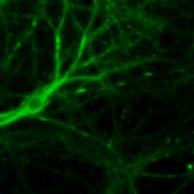 Immunocytochemistry/Immunofluorescence: Muscarinic Acetylcholine Receptor 1 Antibody [NBP1-87466] - Staining of human dissociated rat hippocampal culture. Image courtesy of Janosch Heller, University College London.