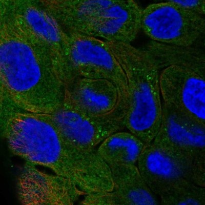 Immunocytochemistry/Immunofluorescence: Perilipin-4 Antibody [NBP2-13776] - Staining of human cell line RT4 shows localization to plasma membrane, cytosol & lipid droplets.