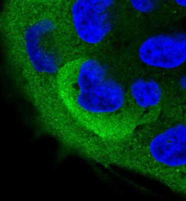 Immunocytochemistry/Immunofluorescence: Perilipin-4 Antibody [NBP2-13776] - Staining of human cell line RT4 shows positivity in plasma membrane, cytoplasm & vesicles. Antibody staining is shown in green.