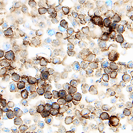 DPPIV/CD26 was detected in immersion fixed frozen sections of mouse thymus using Goat Anti-Mouse DPPIV/CD26 Antigen Affinity-purified Polyclonal Antibody (Catalog # AF954) at 1.7 µg/mL overnight at 4 °C. Tissue was stained using the Anti-Goat HRP-DAB Cell & Tissue Staining Kit (brown; Catalog # CTS008) and counterstained with hematoxylin (blue). Specific staining was localized to lymphocytes. View our protocol for Chromogenic IHC Staining of Frozen Tissue Sections.