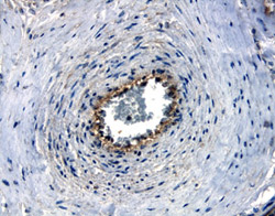 Nectin‑4 was detected in immersion fixed paraffin-embedded sections of human placenta using 10 µg/mL Goat Anti-Human Nectin‑4 Antigen Affinity-purified Polyclonal Antibody (Catalog # AF2659) overnight at 4 °C. Before incubation with the primary antibody tissue was subjected to heat-induced epitope retrieval using Antigen Retrieval Reagent-Basic (Catalog # CTS013). Tissue was stained with the Anti-Goat HRP-DAB Cell & Tissue Staining Kit (brown; Catalog # CTS008) and counterstained with hematoxylin (blue). View our protocol for Chromogenic IHC Staining of Paraffin-embedded Tissue Sections.