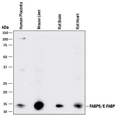 Western  blot shows lysates of human placenta tissue, mouse liver tissue, rat brain  tissue, and rat heart tissue. PVDF membrane was probed with  0.5 µg/mL of Goat Anti-Human/Mouse/Rat FABP5/E‑FABP Antigen  Affinity-purified Polyclonal Antibody (Catalog # AF1476) followed by  HRP-conjugated Anti-Goat IgG Secondary Antibody (Catalog # HAF017).  A specific band was detected for FABP5/E‑FABP at approximately  15 kDa (as indicated). This experiment was conducted under reducing  conditions and using Immunoblot  Buffer Group 1.