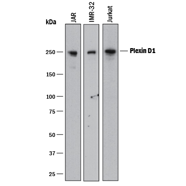 Western blot shows lysates of JAR human choriocarcinoma cell line, IMR‑32 human neuroblastoma cell line, and Jurkat human acute T cell leukemia cell line. PVDF membrane was probed with 0.5 µg/mL of Goat Anti-Human Plexin D1 Antigen Affinity-purified Polyclonal Antibody (Catalog # AF4160) followed by HRP-conjugated Anti-Goat IgG Secondary Antibody (Catalog # HAF017). A specific band was detected for Plexin D1 at approximately 250 kDa (as indicated). This experiment was conducted under reducing conditions and using Immunoblot Buffer Group 1.