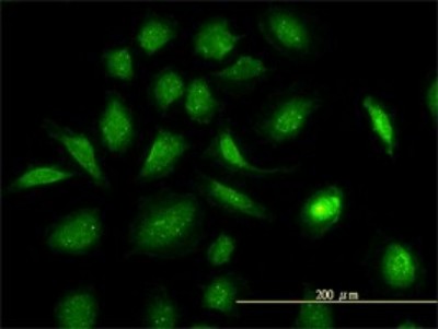 Immunocytochemistry/Immunofluorescence: GART Antibody (4D6-1D5) [H00002618-M01] - Analysis of monoclonal antibody to GART on HeLa cell. Antibody concentration 10 ug/ml.