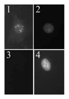 Immunocytochemistry/Immunofluorescence: p19ARF Antibody (12-A1-1) [NB200-169] - Immunofluorescent detection of p19Arf in wild type mouse embryo fibroblasts (MEF) at passage 5 (lanes 1, 2) and NIH3T3 cells, which have deleted the Arf gene (lanes 3, 4) were fixed in methanol/acetone and probed with NB200-169, followed by a fluorescently labeled anti-rat IgG secondary antibody (lanes 1, 3). Cells were also stained with Hoechst dye to reveal the position of nuclei (lanes 2, 4).