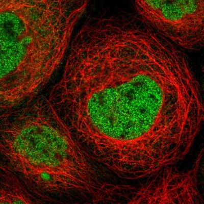 Immunocytochemistry/Immunofluorescence: Mkl1 Antibody [NBP1-88498] - Immunofluorescent staining of human cell line A-431 shows localization to nucleoplasm.