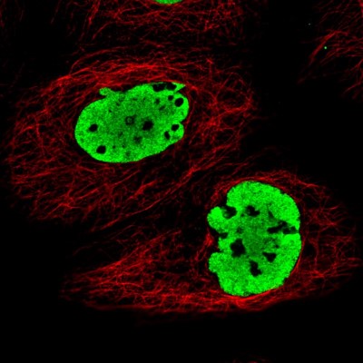 Immunocytochemistry/Immunofluorescence: FUS Antibody (CL0190) [NBP2-52874] - Staining in A431 cell line with Anti-FUS monoclonal antibody, showing clear nuclear (without nucleoli) staining in green. Microtubule- and nuclear probes are visualized in red and blue respectively (where available).