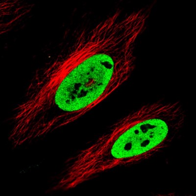 Immunocytochemistry/Immunofluorescence: FUS Antibody (CL0190) [NBP2-52874] - Staining in HeLa cell line with Anti-FUS monoclonal antibody, showing clear nuclear (without nucleoli) staining in green. Microtubule- and nuclear probes are visualized in red and blue respectively (where available).