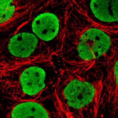 Immunocytochemistry/Immunofluorescence: FUS Antibody (CL0190) [NBP2-52874] - Staining in MCF7 cell line with Anti-FUS monoclonal antibody, showing clear nuclear (without nucleoli) staining in green. Microtubule- and nuclear probes are visualized in red and blue respectively (where available).