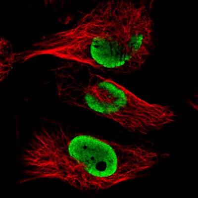 Immunocytochemistry/Immunofluorescence: FUS Antibody (CL0190) [NBP2-52874] - Staining in U251 cell line with Anti-FUS monoclonal antibody, showing clear nuclear (without nucleoli) staining in green. Microtubule- and nuclear probes are visualized in red and blue respectively (where available).