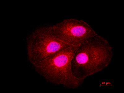 Immunocytochemistry/Immunofluorescence: LIS1 Antibody [NBP1-87769] - Staining  LIS1 in Caco-2 cells using anti-LIS1 antibody. Image from verified customer review.