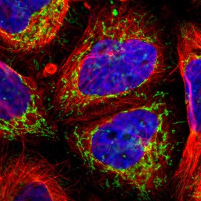 Immunofluorescence: ECH1 Antibody [NBP1-83215] - Staining of human cell line A-431 shows positivity in mitochondria.