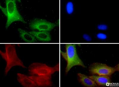 Immunocytochemistry/Immunofluorescence: TRPM8 Antibody [NBP1-97311] -  TRPM8 antibody was tested in U2OS cells with FITC (green). Nuclei and alpha-tubulin were counterstained with DAPI (blue) and Dylight 550 (red).