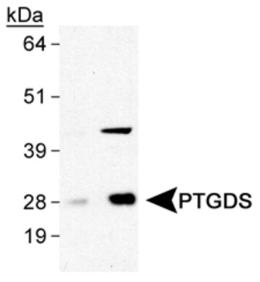 Western Blot: Prostaglandin D Synthase/Lipocalin Antibody [NB110-59911] - Detection of PTGDS in human brain lysates (NB820-59177) using NB110-59911 at 0.5 and 2.0 ug/ml.