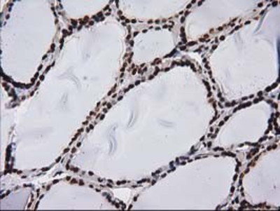 Immunohistochemistry-Paraffin: V-type proton ATPase subunit F Antibody (1B8) [NBP2-03498] - Staining of paraffin-embedded Human thyroid tissue using anti-V-type proton ATPase subunit F mouse monoclonal antibody.