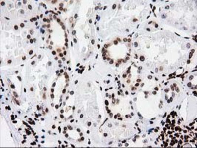 Immunohistochemistry-Paraffin: V-type proton ATPase subunit F Antibody (1B8) [NBP2-03498] - Staining of paraffin-embedded Human Kidney tissue using anti-V-type proton ATPase subunit F mouse monoclonal antibody.