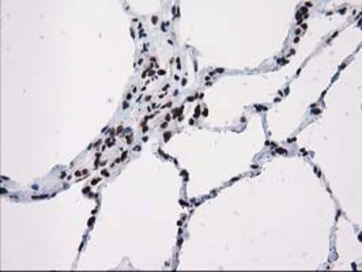 Immunohistochemistry-Paraffin: V-type proton ATPase subunit F Antibody (1B8) [NBP2-03498] - Staining of paraffin-embedded Human lung tissue using anti-V-type proton ATPase subunit F mouse monoclonal antibody.