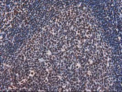 Immunohistochemistry-Paraffin: V-type proton ATPase subunit F Antibody (1B8) [NBP2-03498] - Staining of paraffin-embedded Human lymph node tissue using anti-V-type proton ATPase subunit F mouse monoclonal antibody.