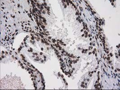 Immunohistochemistry-Paraffin: V-type proton ATPase subunit F Antibody (1B8) [NBP2-03498] - Staining of paraffin-embedded Human prostate tissue using anti-V-type proton ATPase subunit F mouse monoclonal antibody.