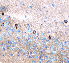 Leptin/OB was detected in perfusion fixed frozen sections of mouse brain using Mouse Leptin/OB Antigen Affinity-purified Polyclonal Antibody (Catalog # AF498) at 5 µg/mL overnight at 4 °C. Tissue was stained using the Anti-Goat HRP-DAB Cell & Tissue Staining Kit (brown; Catalog # CTS008) and counterstained with hematoxylin (blue). Specific staining was localized to neuronal cytoplasm. View our protocol for Chromogenic IHC Staining of Frozen Tissue Sections.