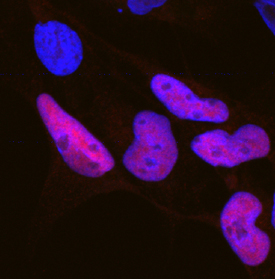 SOX10 was detected in immersion fixed BG01V human embryonic stem cells differentiated to neural crest stem cells using Goat Anti-Human SOX10 Antigen Affinity-purified Polyclonal Antibody (Catalog # AF2864) at 10 µg/mL for 3 hours at room temperature. Cells were stained using the NorthernLights™ 557-conjugated Anti-Goat IgG Secondary Antibody (red; Catalog # NL001) and counterstained with DAPI (blue). Specific staining was localized to nuclei. View our protocol for Fluorescent ICC Staining of Cells on Coverslips.