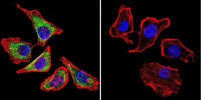 Immunocytochemistry/Immunofluorescence: Sodium-Calcium Exchanger Antibody (C2C12) [NB120-2869] - Sodium/Calcium Exchanger staining (green), F-Actin staining with Phalloidin (red) and nuclei with DAPI (blue) is shown. Cells were grown on chamber slides and fixed with formaldehyde prior to staining. Cells were probed without (control) or with or an antibody recognizing Sodium/Calcium Exchanger at a dilution of 1:100 over night at 4C, washed with PBS and incubated with a DyLight-488 conjugated.