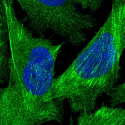 Immunocytochemistry/Immunofluorescence: Caldesmon/CALD1 Antibody [NBP1-85702] - Immunofluorescent staining of human cell line U-2 OS shows localization to plasma membrane & actin filaments.