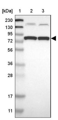 Western Blot: SorCS1 Antibody [NBP1-86096] - Lane 1: Marker  [kDa] 230, 130, 95, 72, 56, 36, 28, 17, 11.  Lane 2: Human cell line RT-4.  Lane 3: Human cell line U-251MG sp