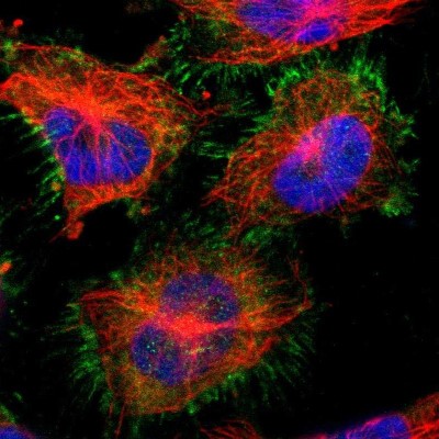 Immunocytochemistry/Immunofluorescence: SorCS1 Antibody [NBP1-86096] - Immunofluorescent staining of human cell line U-251 MG shows localization to plasma membrane & cytosol.
