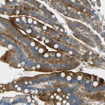 Immunohistochemistry-Paraffin: SorCS1 Antibody [NBP1-86096] - Staining of human colon shows strong cytoplasmic and membranous positivity in glandular cells.