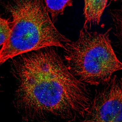 Immunocytochemistry/Immunofluorescence: ARHGAP1 Antibody [NBP1-85724] - Immunofluorescent staining of human cell line U-251 MG shows localization to vesicles.