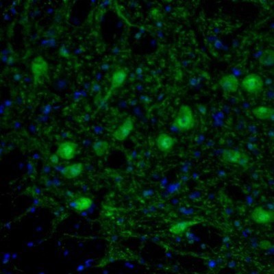 Immunocytochemistry/Immunofluorescence: ARHGAP1 Antibody [NBP1-85724] - Staining of mouse brain shows neuronal staining in lateral paragigantocellular nucleus.