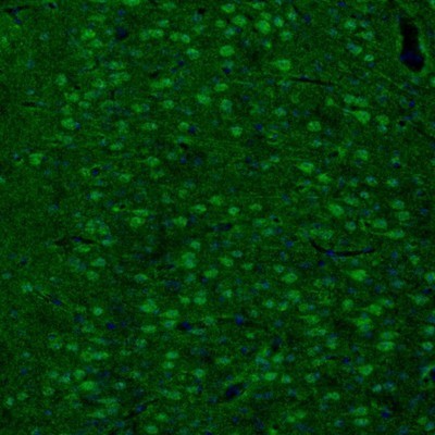 Immunocytochemistry/Immunofluorescence: ARHGAP1 Antibody [NBP1-85724] - Staining of mouse cingulate cortex shows cytoplasmic immunoreactivity in neurons.