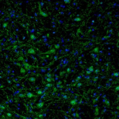 Immunocytochemistry/Immunofluorescence: ARHGAP1 Antibody [NBP1-85724] - Staining of mouse motor trigeminal nucleus shows positivity in neuronal cells bodies and processes.