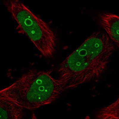 Immunocytochemistry/Immunofluorescence: DDX21 Antibody [NBP1-83310] - Immunofluorescent staining of human cell line U-251 MG shows localization to nucleus & nucleoli.