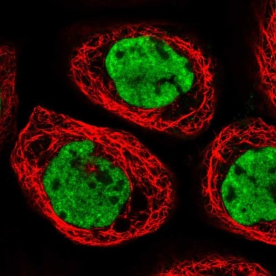 Immunocytochemistry/Immunofluorescence: CPSF6 Antibody [NBP1-85676] - Staining of human cell line A-431 shows localization to nucleoplasm & nuclear speckles.