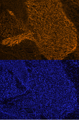 PRDM16 was detected in immersion fixed frozen sections of mouse embryo (E13.5) using Sheep Anti-Human/Mouse PRDM16 Antigen Affinity-purified Polyclonal Antibody (Catalog # AF6295) at 10 µg/mL overnight at 4 °C. Tissue was stained using the NorthernLights™ 557-conjugated Anti-Sheep IgG Secondary Antibody (orange, upper panel; Catalog # NL010) and counterstained with DAPI (blue, lower panel). Specific staining was localized to the trigeminal ganglion. View our protocol for Fluorescent IHC Staining of Frozen Tissue Sections.
